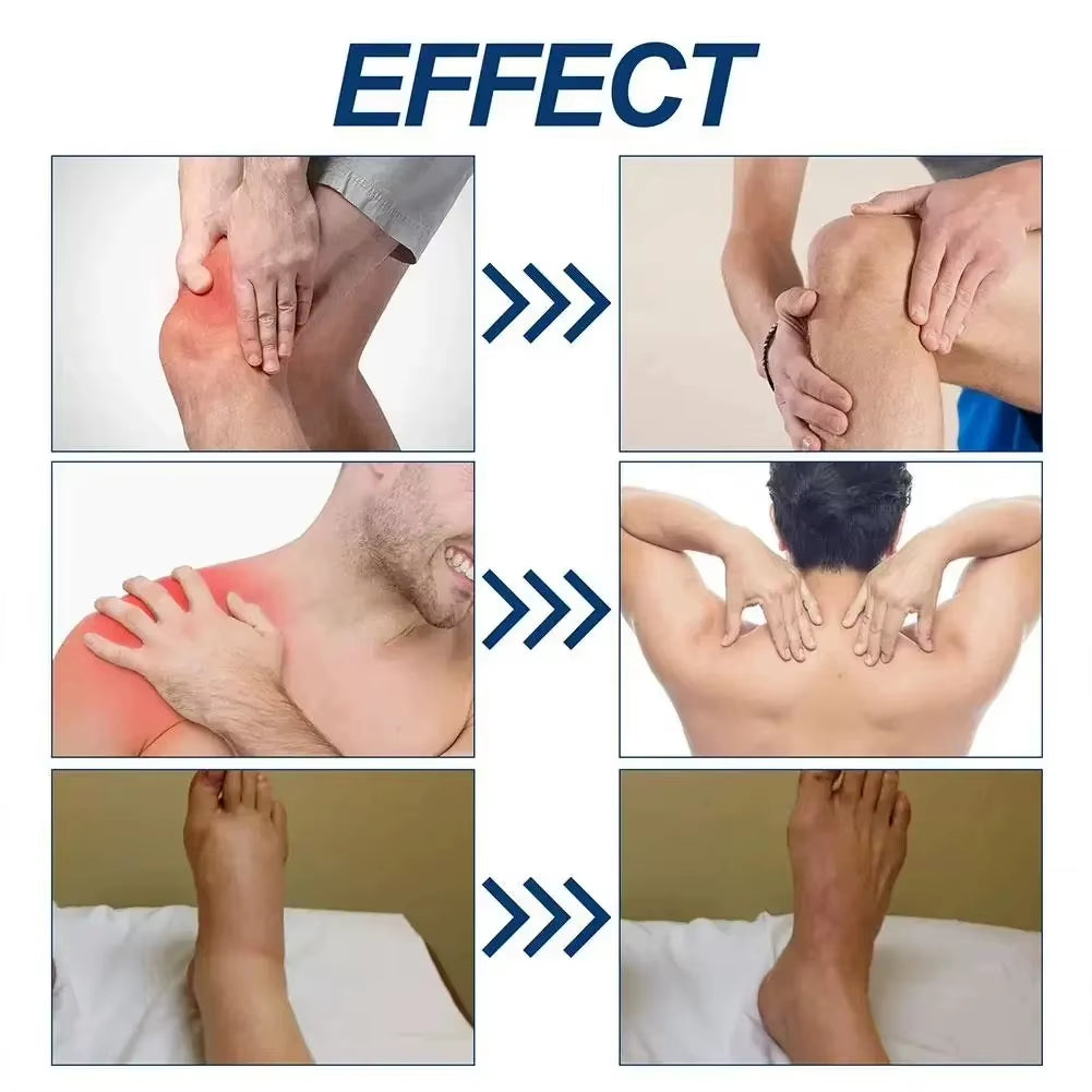 Bee Joint Ointment Professional Treatment Gel Shoulder and Neck Pain Lasting Care Massage Health Care Ointment 50G